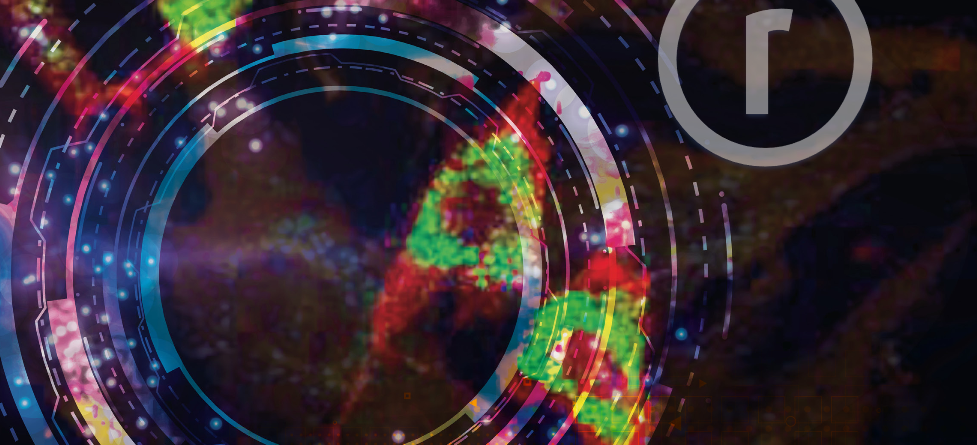 Associação Portuguesa de Doenças do Lisossoma - APL